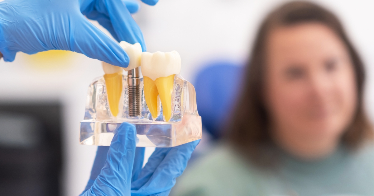 A Confident Smile: The Life-Changing Benefits of Dental Implants