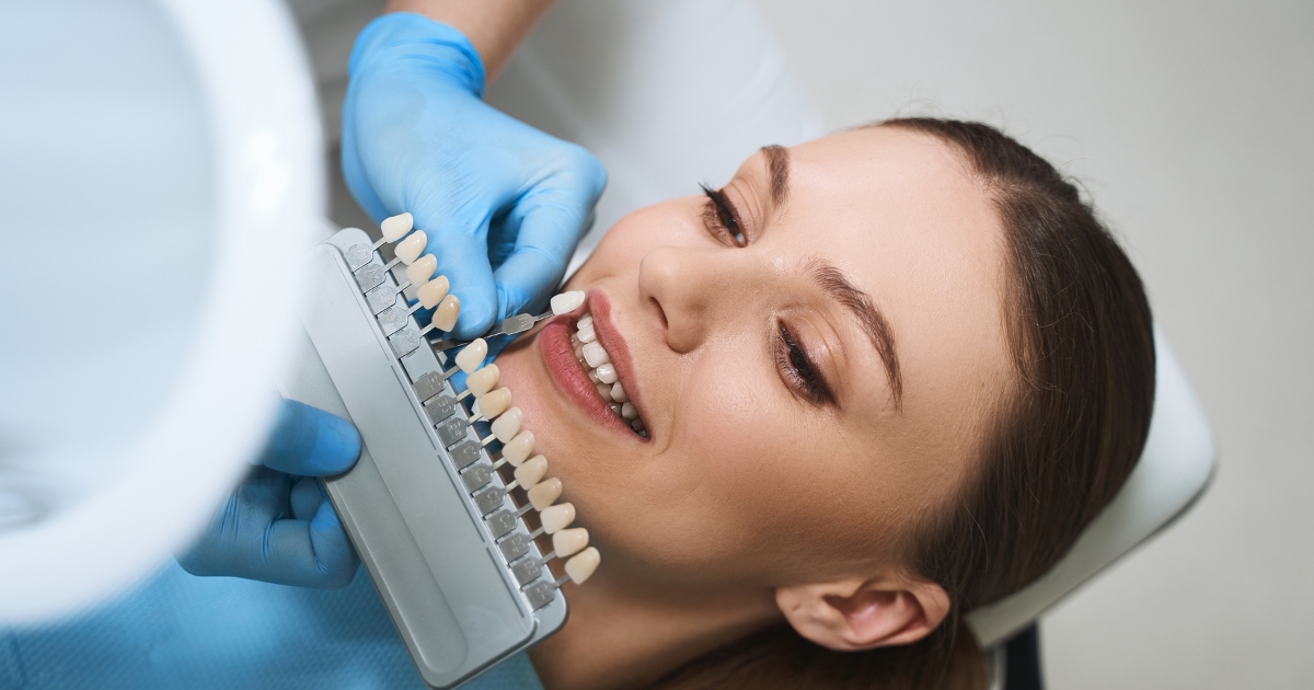 Can You Get Veneers with Crooked or Misaligned Teeth?