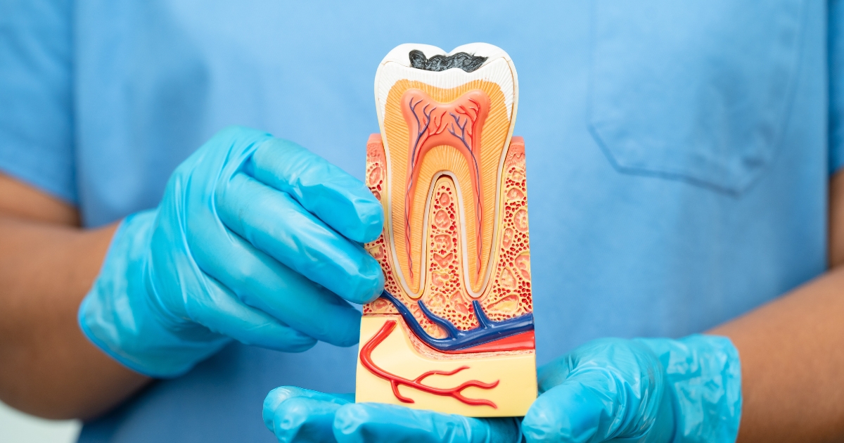 Gum Infection After Root Canal Treatment