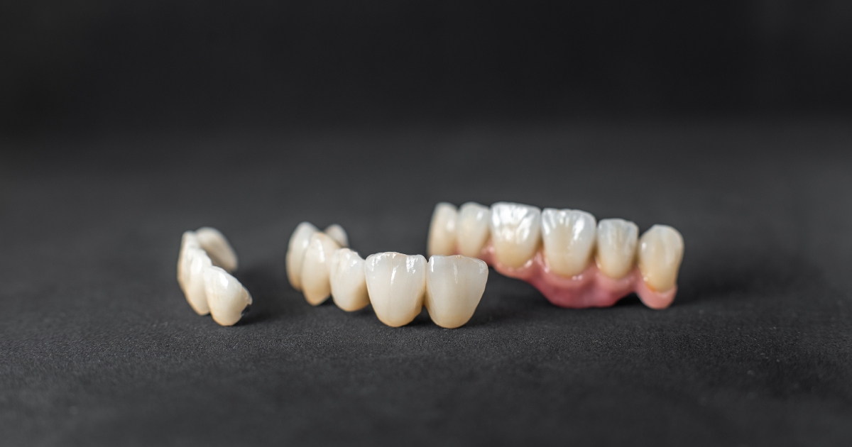 Your Dental Crown Broke? Here Are 5 Steps to Take Immediately